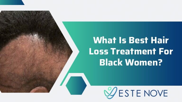 What Is Best Hair Loss Treatment For Black Women? | EsteNove