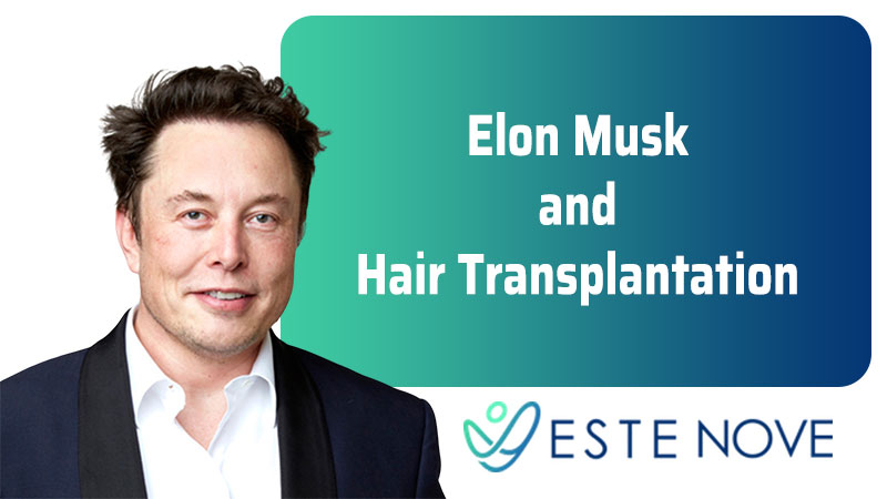Elon Musk and Hair Transplantation - Estenove