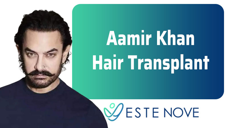 Aamir Khan Hair Transplant