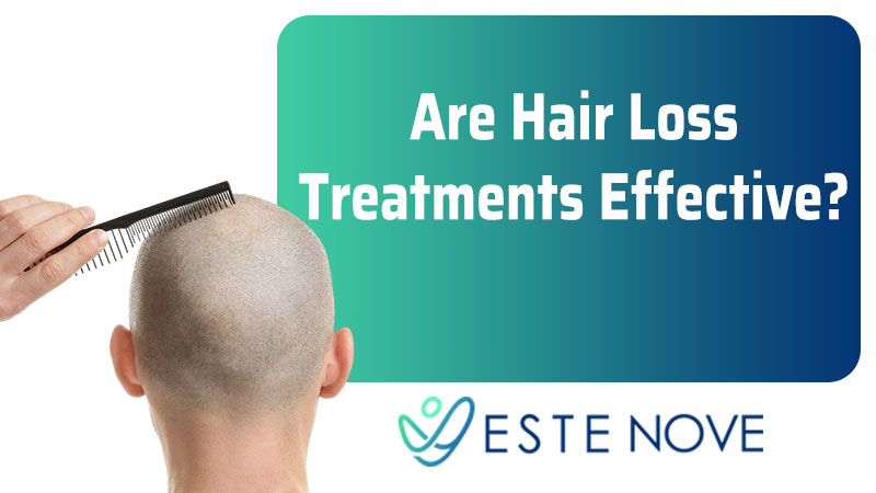 Are Hair Loss Treatments Effective?