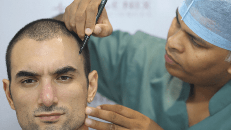 Baldness Cure - Estenove EsteNove Baldness Cure - Estenove EsteNove