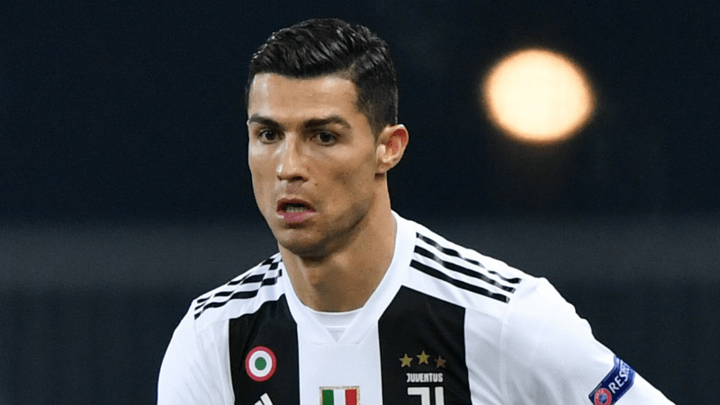 Cristiano Ronaldo Hair Transplant