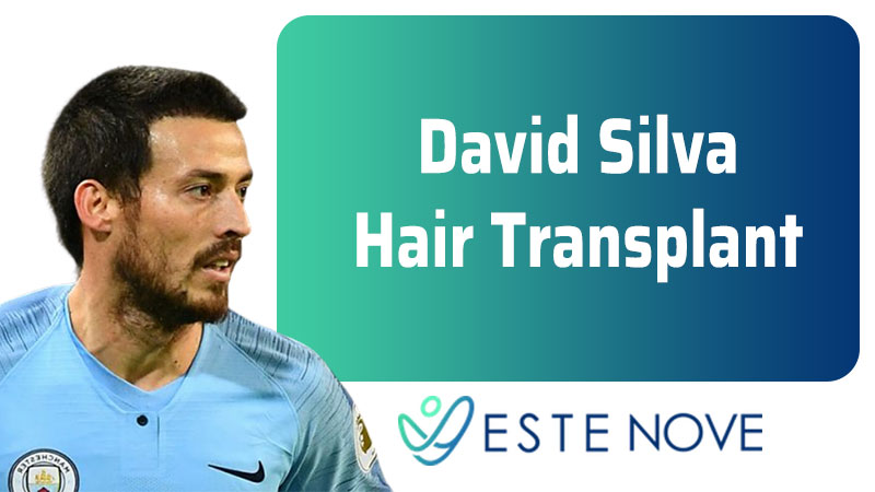 David Silva Hair Transplant