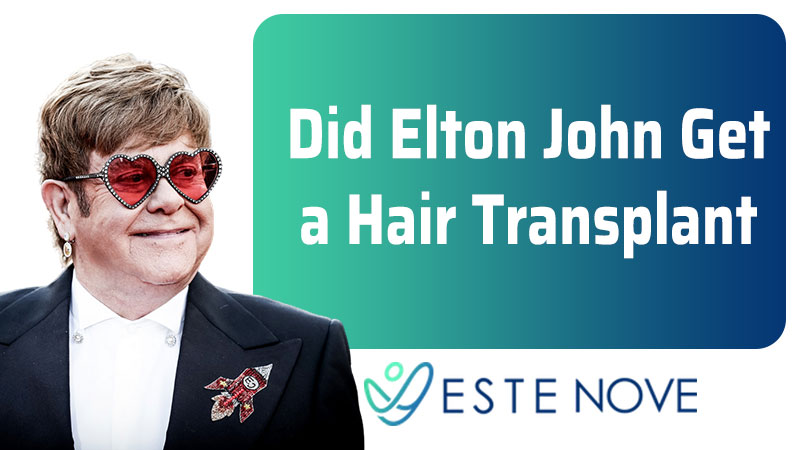 Did Elton John Get a Hair Transplant