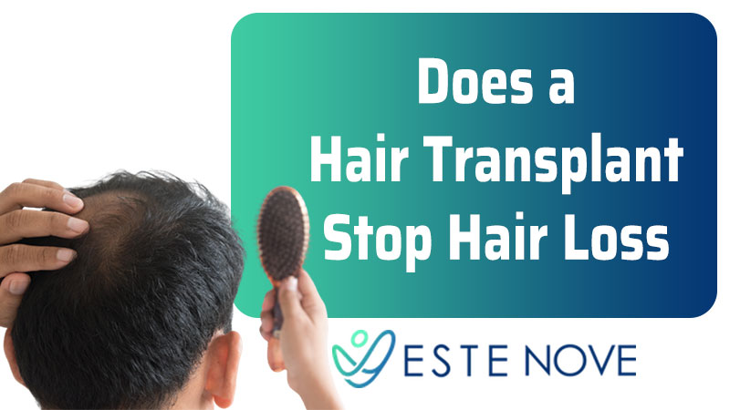 Does a Hair Transplant Stop Hair Loss