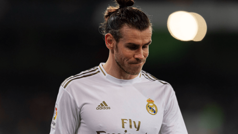 Gareth Bale Hair Transplant