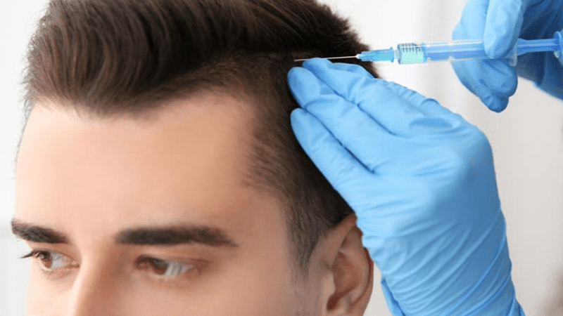 Hair Transplant without Shaving Your Head: Is It Possible