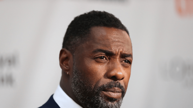 Idris Elba Hair Transplant