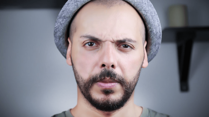 Is it Okay to Wear a Hat after Hair Transplant? - Estenove Is it Okay to Wear a Hat after Hair Transplant? - Estenove