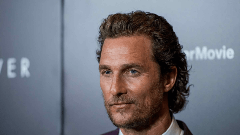 Sean Penn Hair Transplant