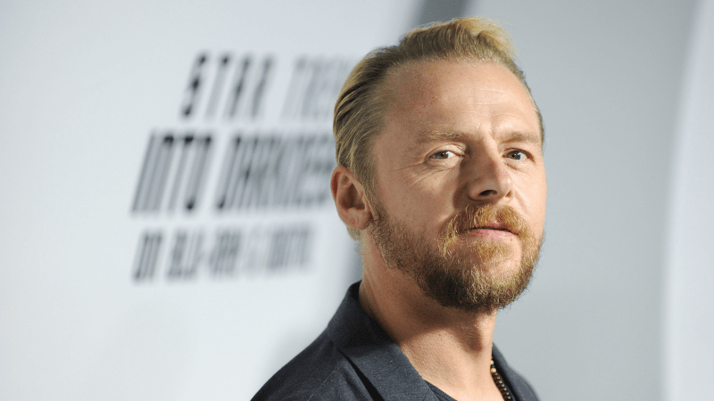 Simon Pegg Hair Transplant