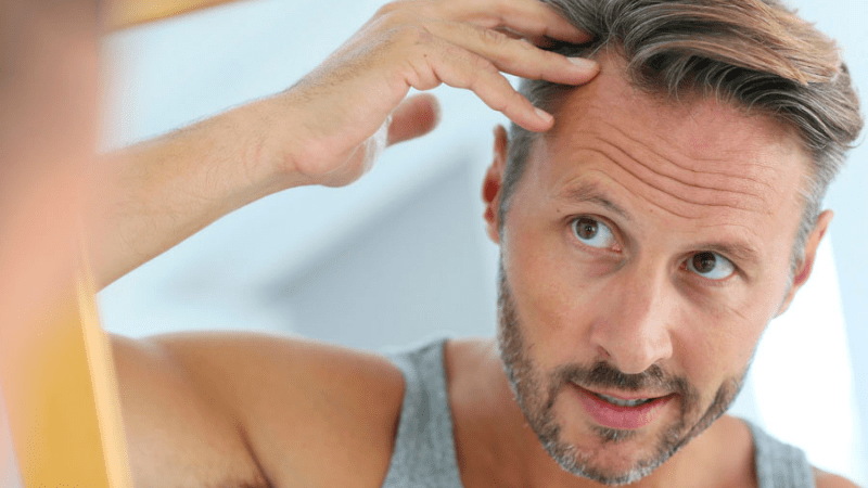 The Best Time To Have a Hair Transplant