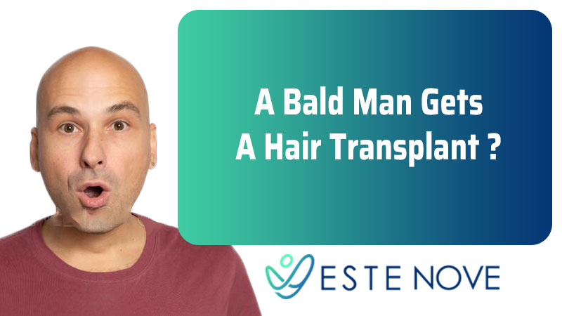 A Bald Man Gets A Hair Transplant