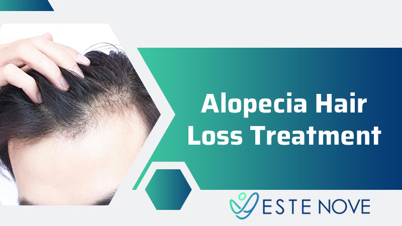 Alopecia Hair Loss Treatment