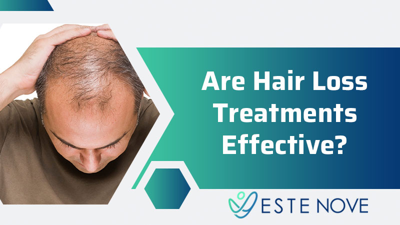 Are Hair Loss Treatments Effective?