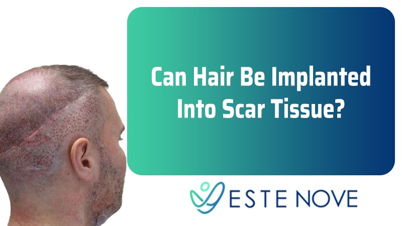 Can Hair Be Implanted Into Scar Tissue?