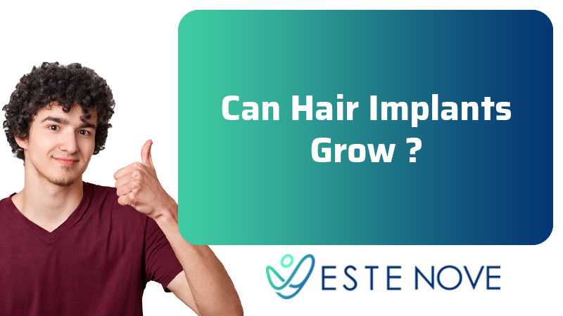 Can Hair Implants Grow?