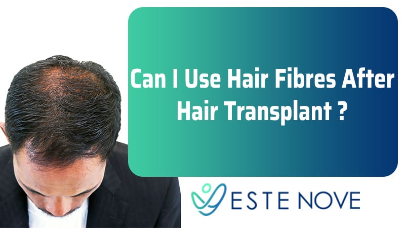 Can I Use Hair Fibres After Hair Transplant - Estenove Can I Use Hair Fibres After Hair Transplant - Estenove