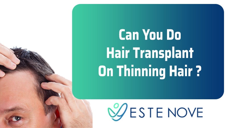 Can You Do Hair Transplant On Thinning Hair - Estenove Can You Do Hair Transplant On Thinning Hair - Estenove