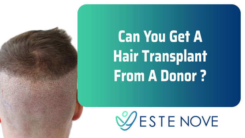 Can You Get A Hair Transplant From A Donor