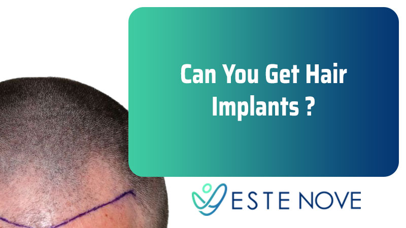 Can You Get Hair Implants