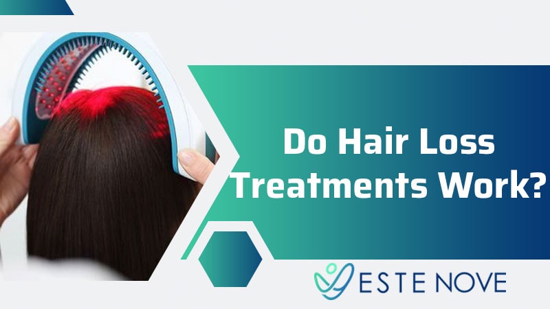 Do Hair Loss Treatments Work?