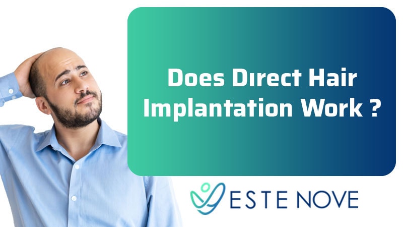 Does Direct Hair Implantation Work