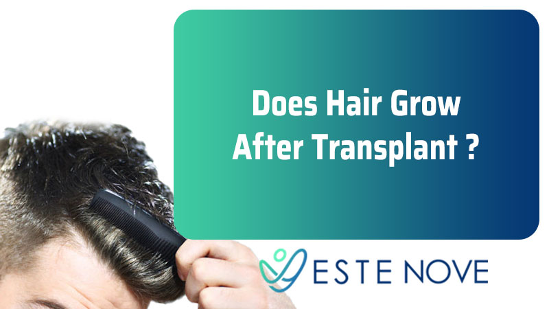 Does Hair Grow After Transplant