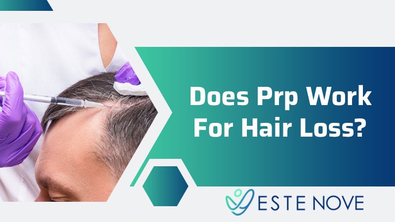 Does PRP Work For Hair Loss?