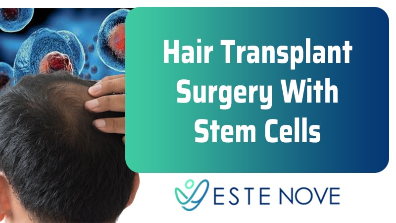 Hair Transplant Surgery With Stem Cells - Estenove