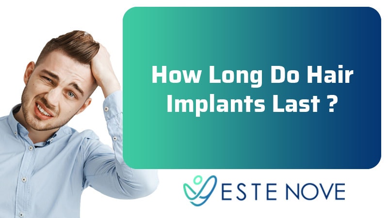 How Long Do Hair Implants Last