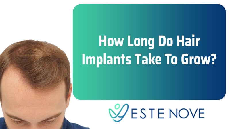 How Long Do Hair Implants Take To Grow