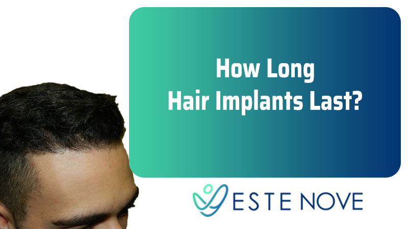 How Long Hair Implants Last