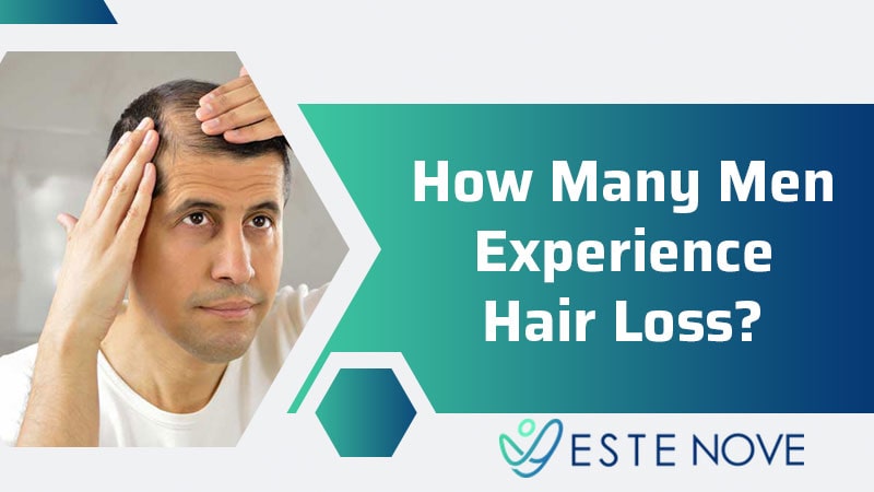 How Many Men Experience Hair Loss?