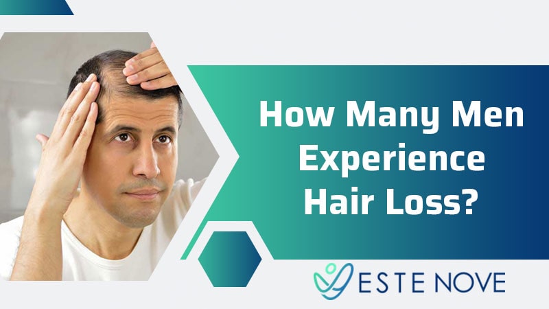 How Many Men Experience Hair Loss? - Estenove How Many Men Experience Hair Loss? - Estenove