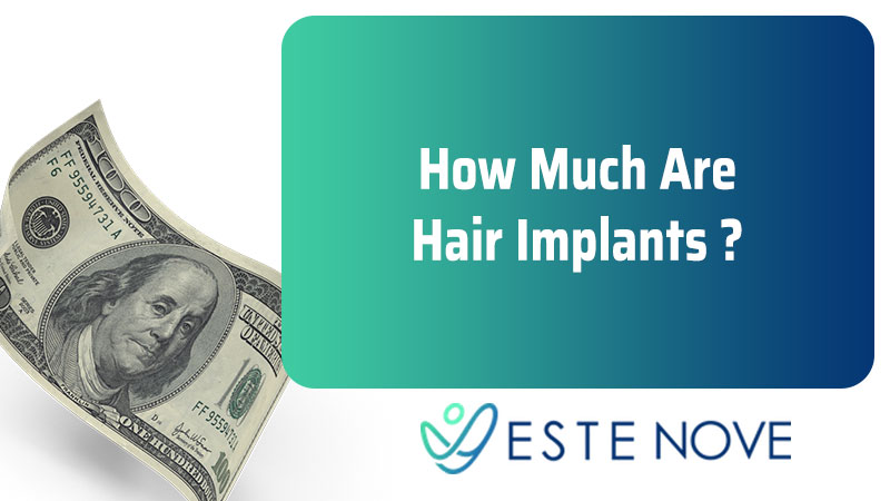 How Much Are Hair Implants