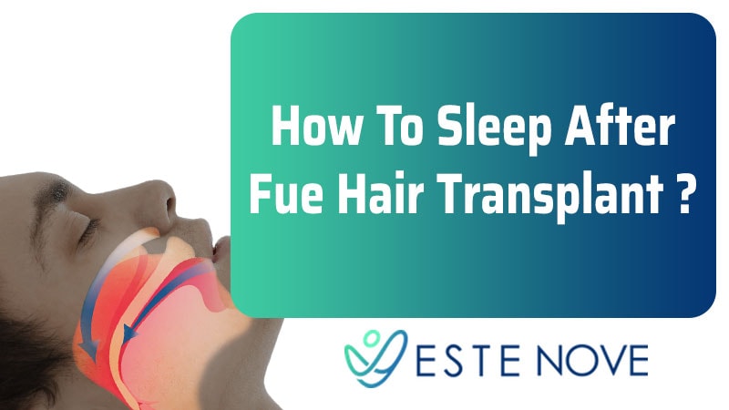 How To Sleep After Fue Hair Transplant
