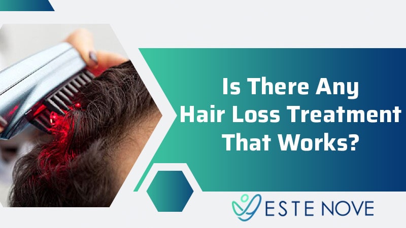 Is There Any Hair Loss Treatment That Works?