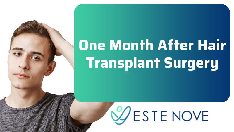 One Month After Hair Transplant Surgery - Estenove
