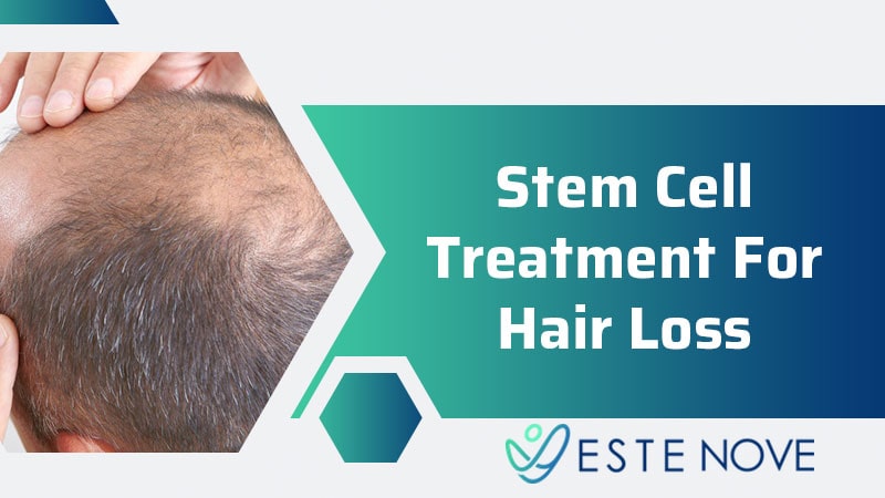 Stem Cell Treatment For Hair Loss - Estenove