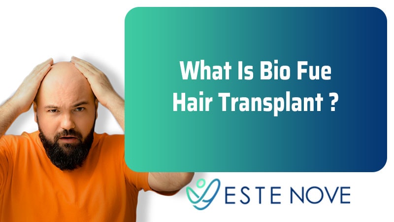 What Is Bio Fue Hair Implant - Estenove
