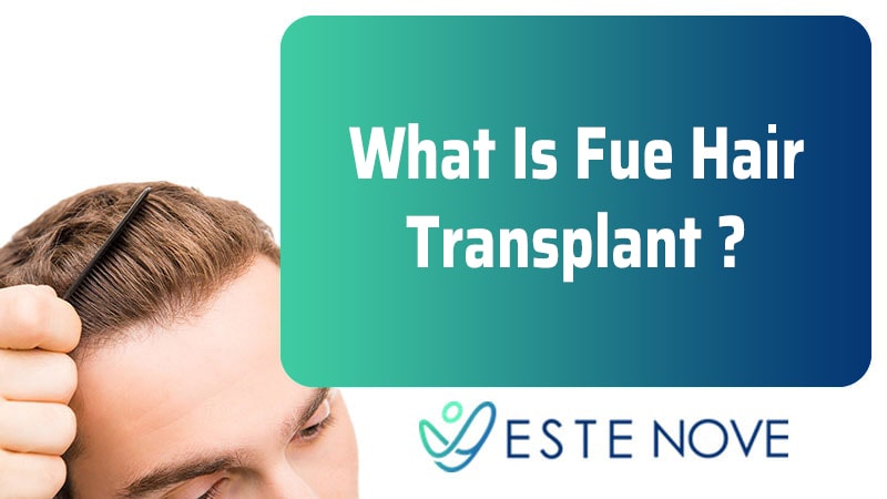 What Is Fue Hair Transplant?