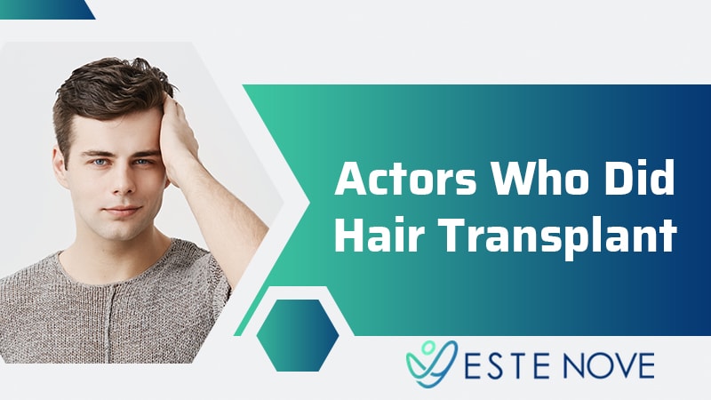 Actors Who Did Hair Transplant?
