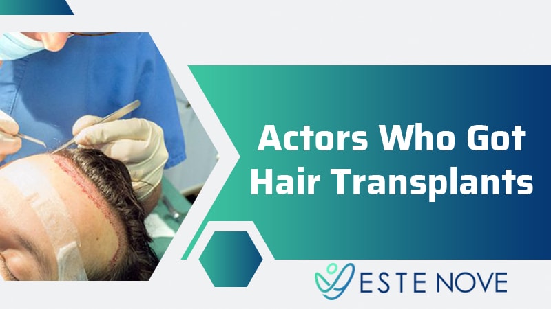 Actors Who Got Hair Transplant?