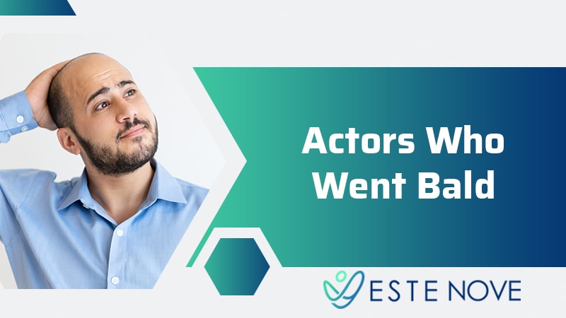 Actors Who Went Bald