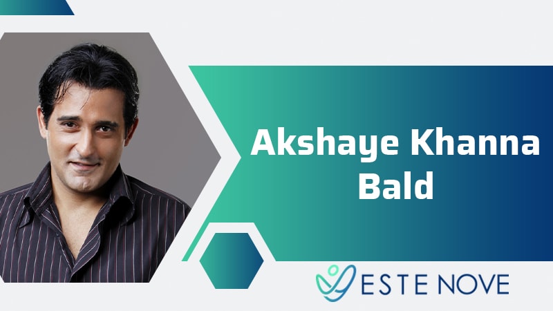 Akshay Khanna Bald