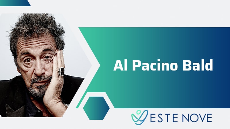 Al Pacino Bald