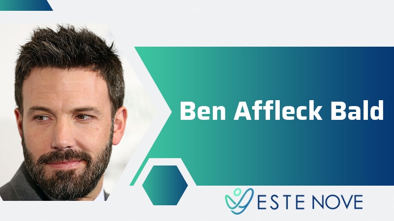 Ben Affleck Bald