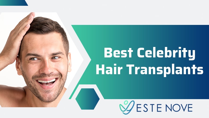 Best Celebrity Hair Transplants