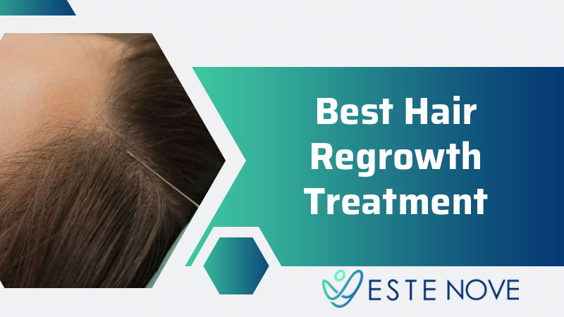 Best Hair Regrowth Treatment